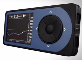 Continuous Glucose Monitoring System Cleared by FDA