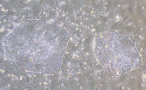Induced Pluripotent stem cells