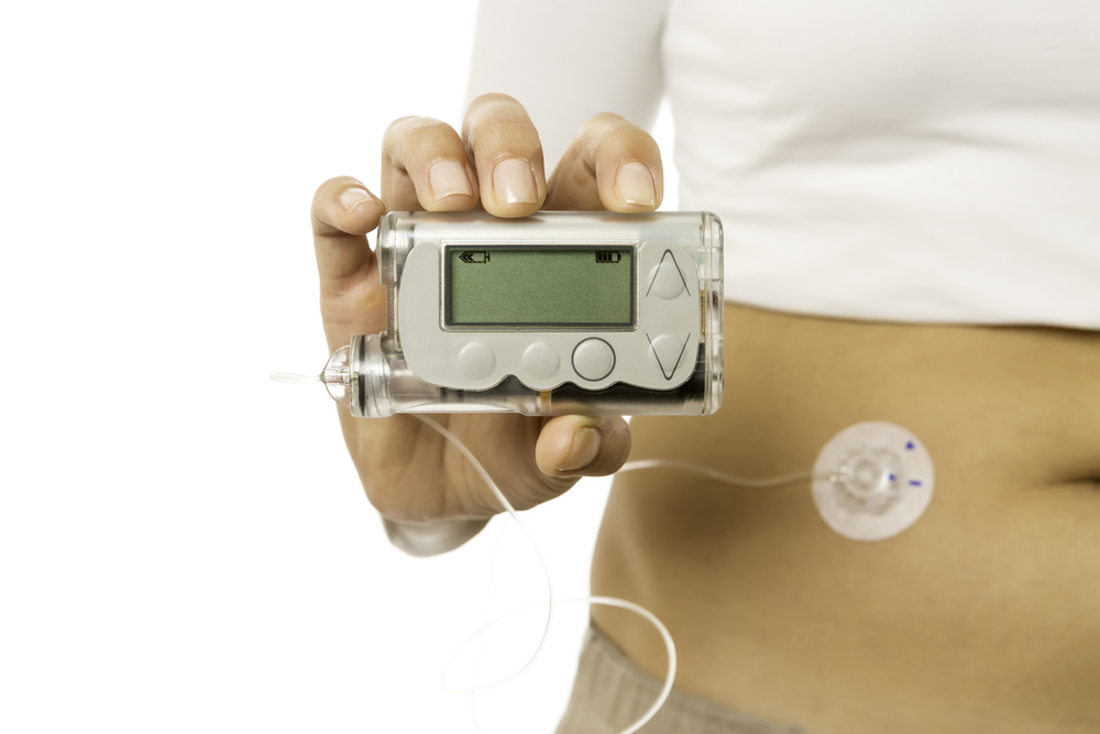 FDA Recommends Glucose Monitors and Insulin Pumps for Diabetes Management