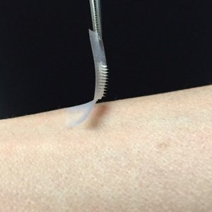 The smart insulin patch could be placed anywhere on the body to detect increases in blood sugar and then secrete doses of insulin when needed. (Photo Courtesy of Zhen Gu, PhD)
