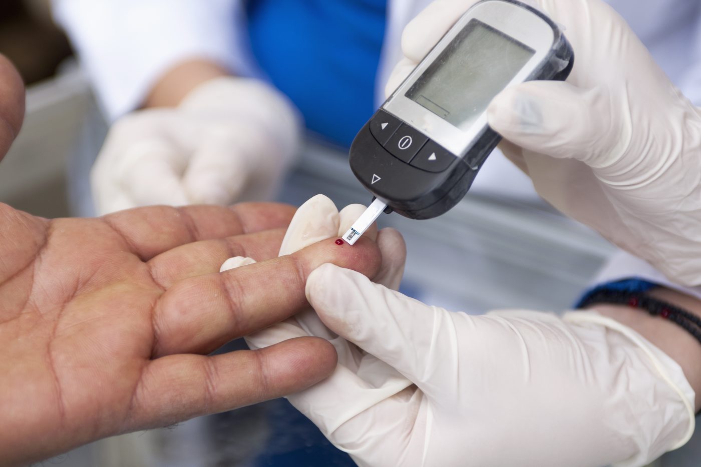 Study Finds That Sleeve Gastrectomy Patients May Develop Diabetes in the Long-Term