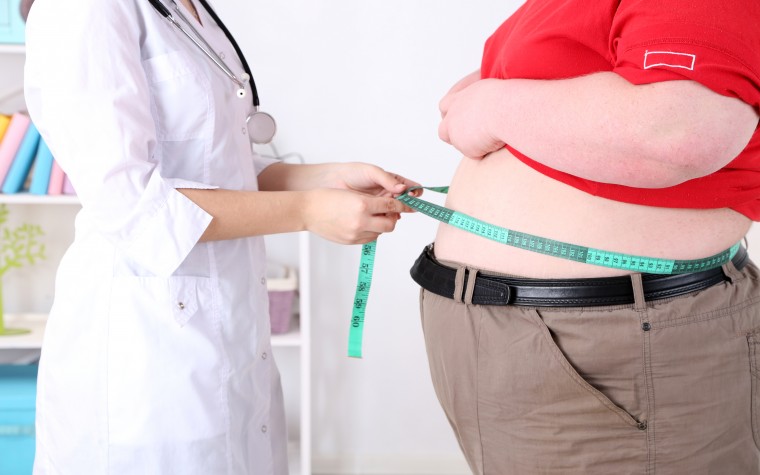 Prader-Willi syndrome and obesity