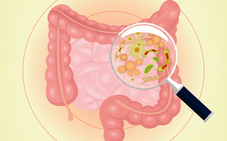 Diabetes, Metabolic Syndrome and gut bacteria