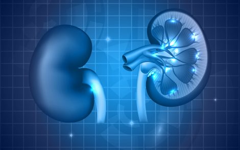 Chronic Kidney Disease Can Cause Diabetes, Study Finds
