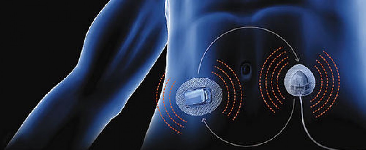 Artificial Pancreas May Improve Diabetics' Glucose Control, Cambridge ...